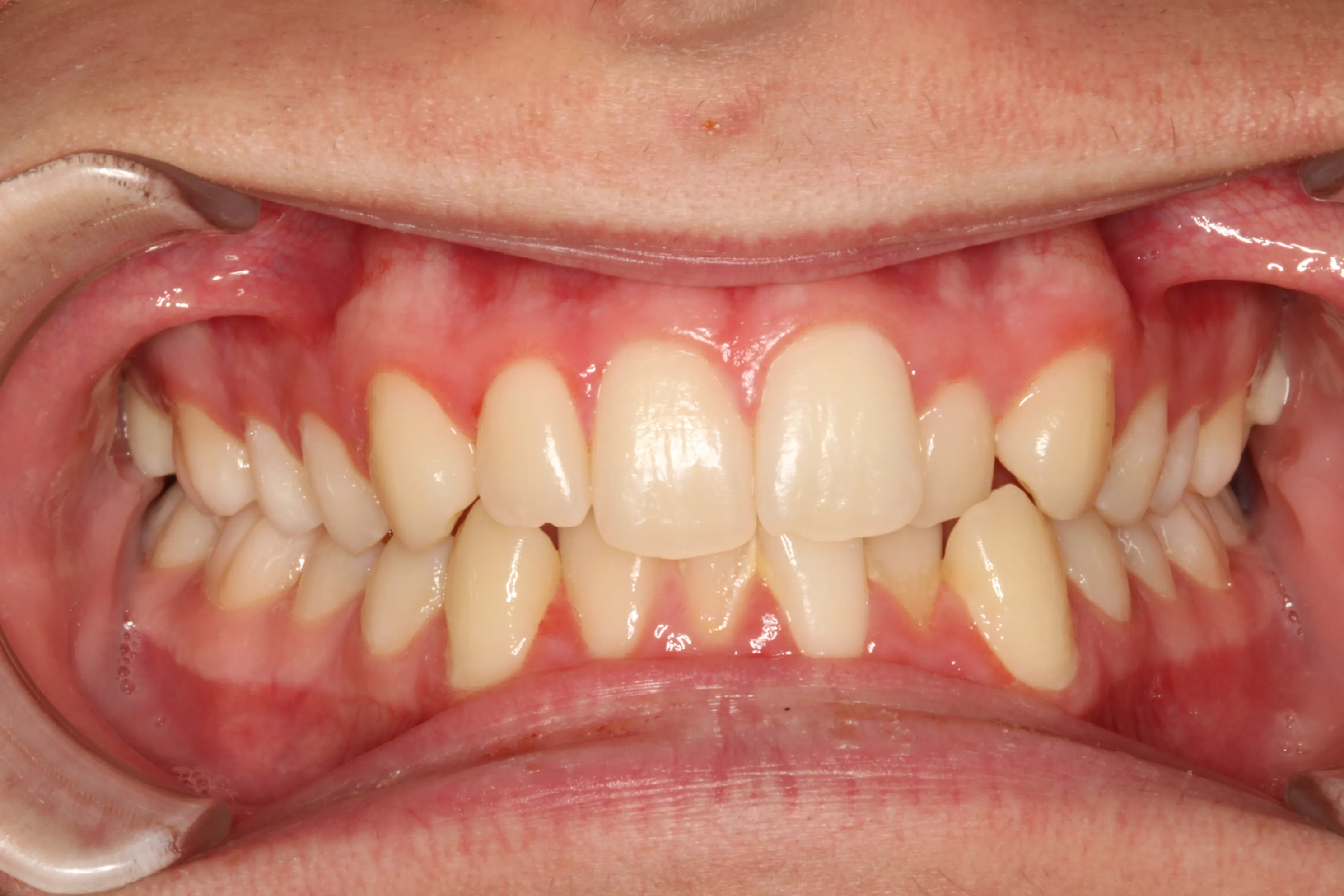 smile-gallery gallery